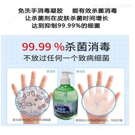 免洗手消毒凝胶厂家电话 免洗手消毒凝胶 现货速发